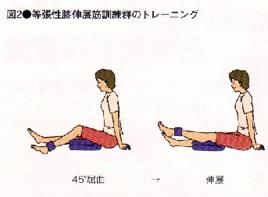 変形性膝関節症